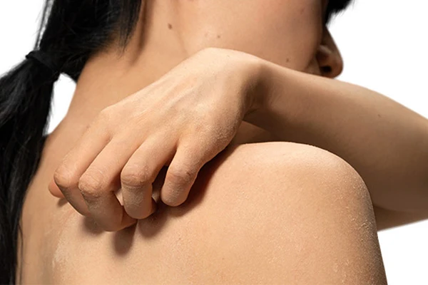 Matka aplikuje krem na delikatną skórę swojego dziecka